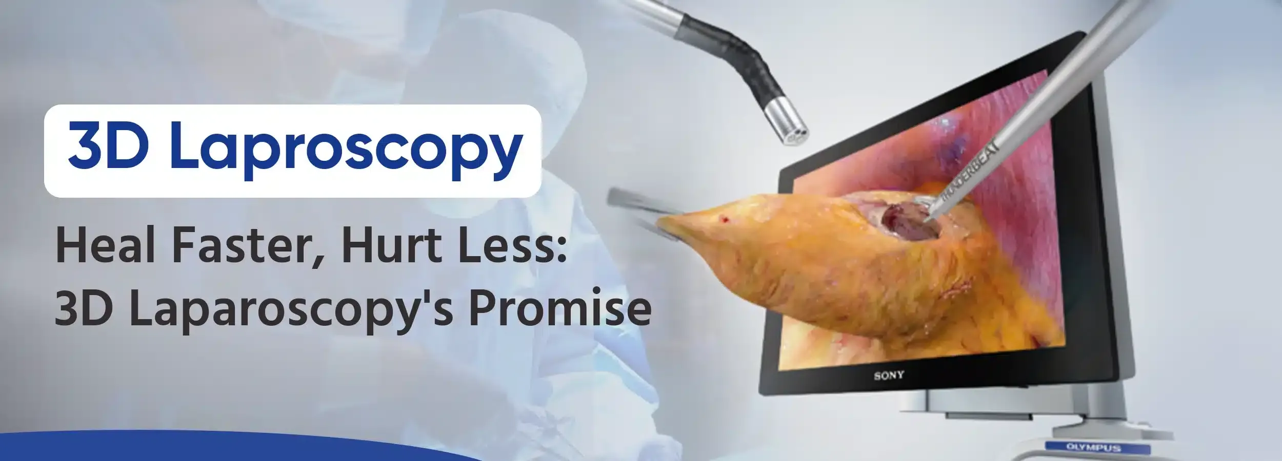 3D laproscopy