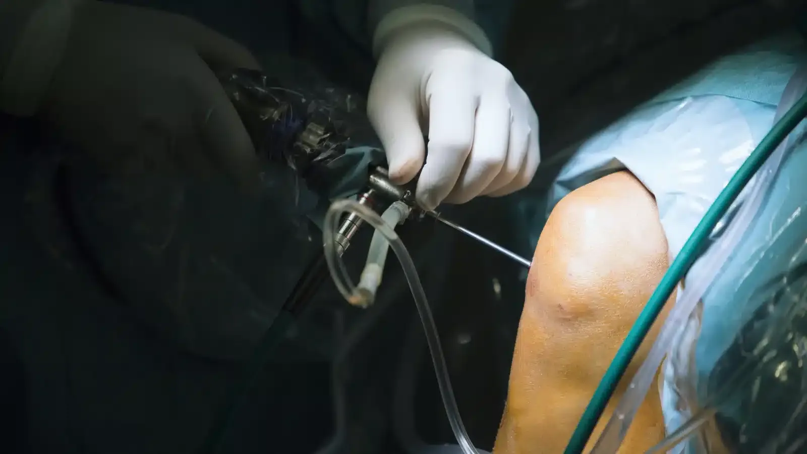 orthopedics treatment