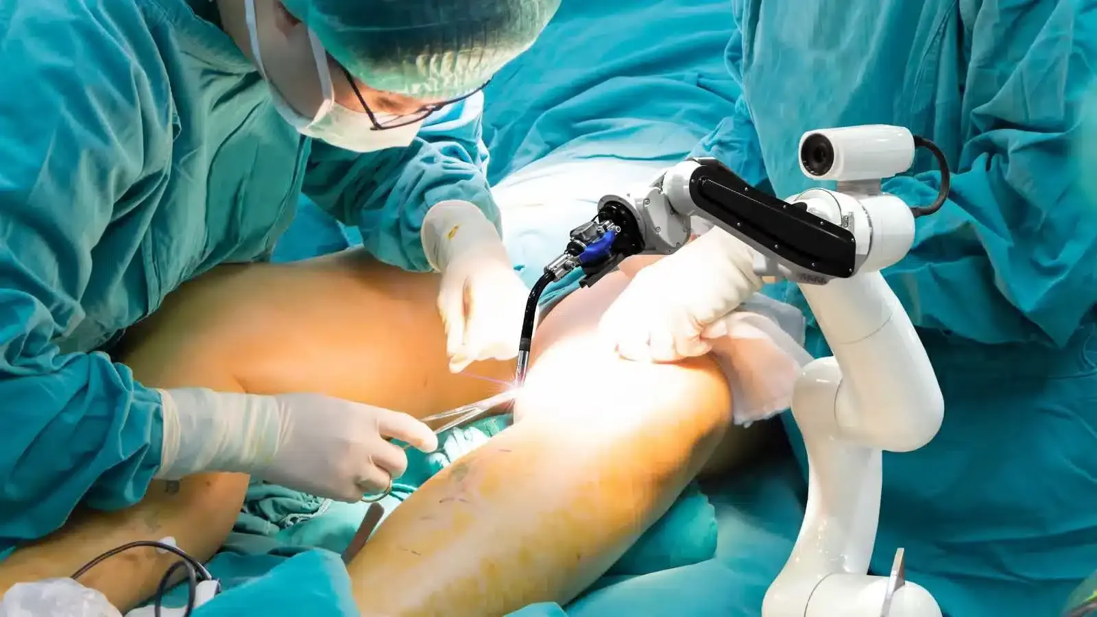 Varicose-Vein-Surgery at sahaj hospital indore