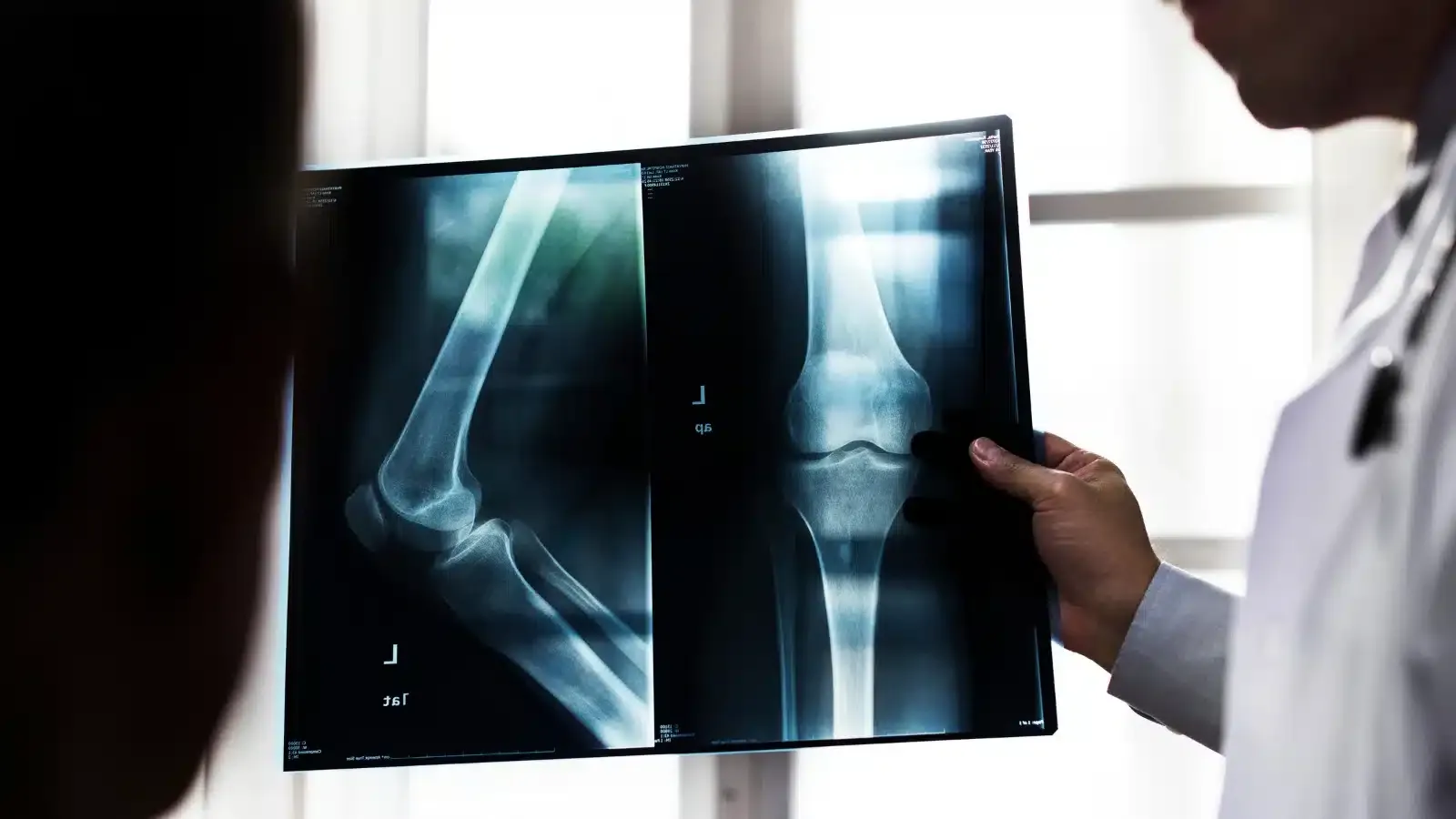 x ray