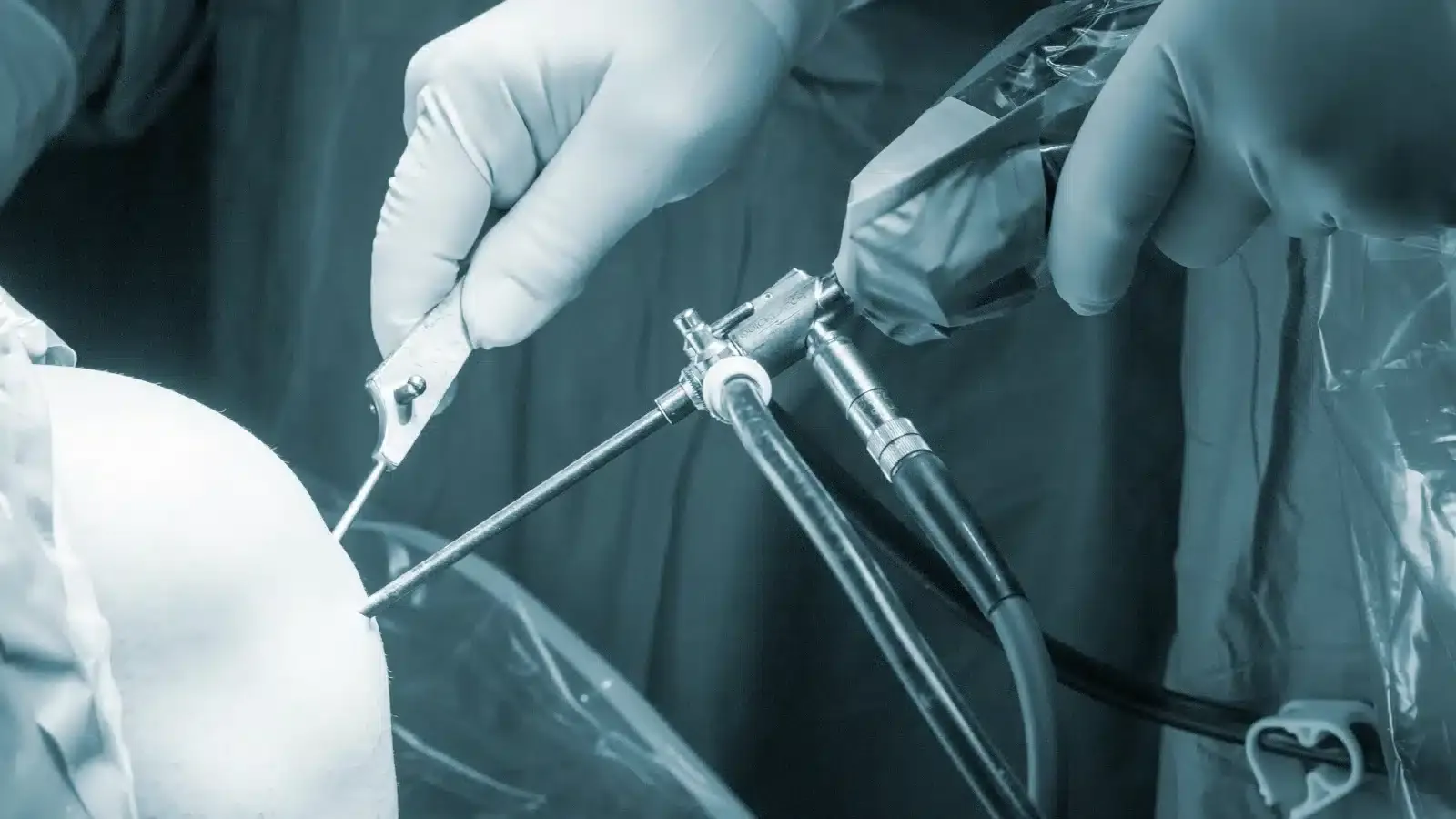 shoulder arthoscopy