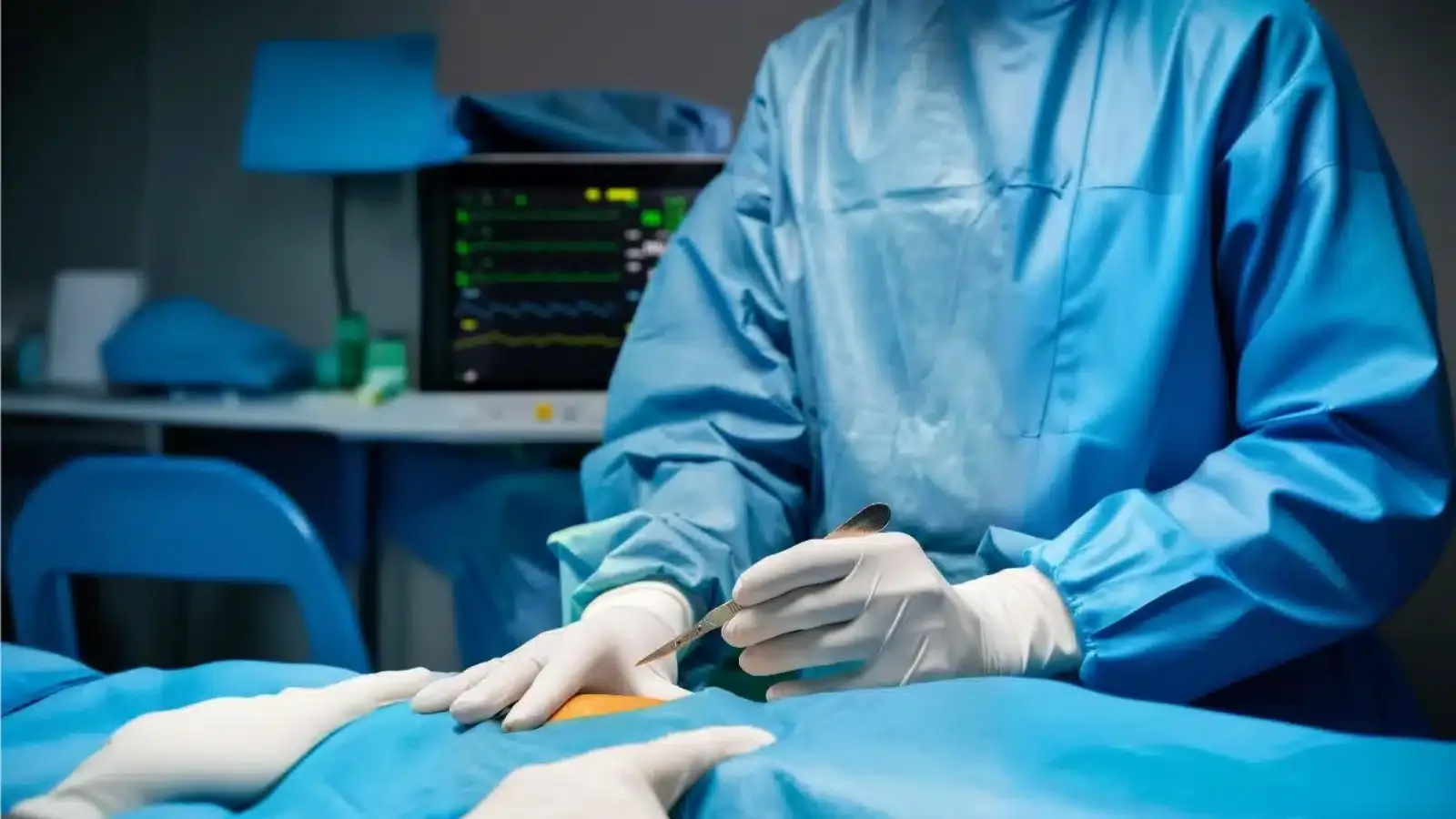 LAP Nephrectomy Sahaj