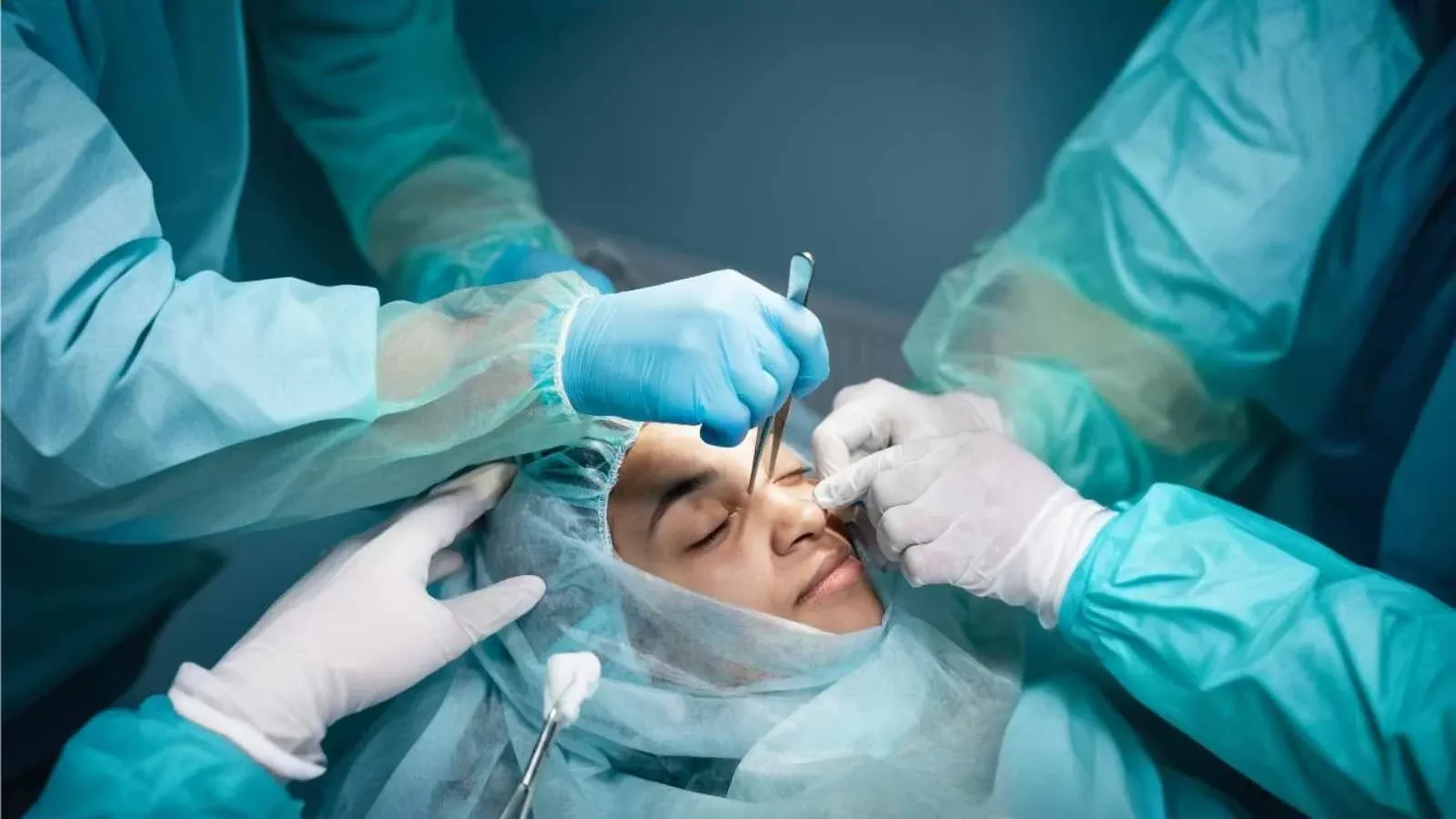 a team of doctors doing Functional endoscopic sinus surgery