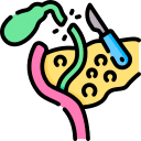 Laproscopic Cholecystectomy