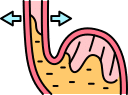 Laproscopic Fundoplication