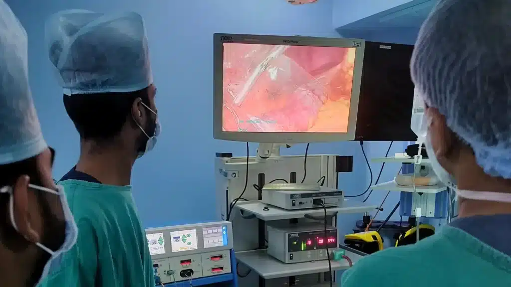 Laparoscopic-Ovarian-Cystectomy-removal-