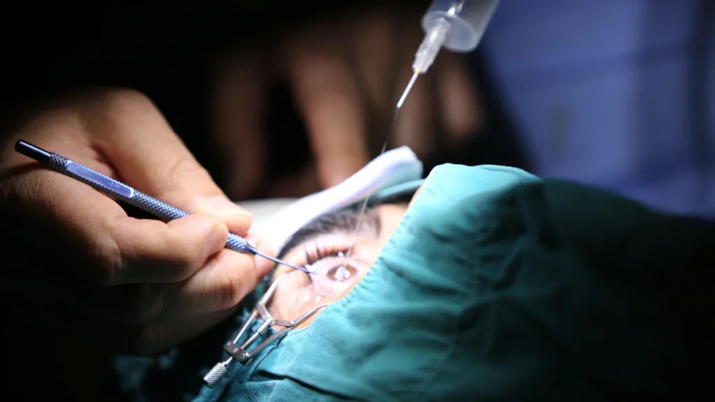 surgical procedure that removes cataracts from the eye